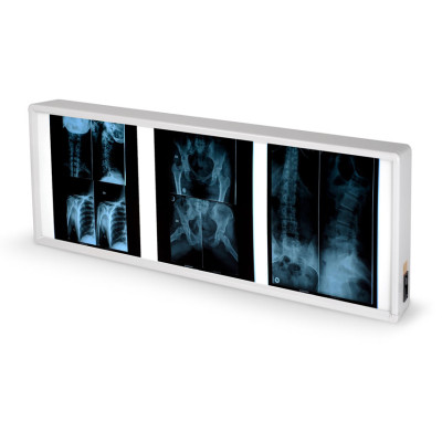 X RAY ILLUMINATOR - double