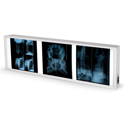 X RAY ILLUMINATOR - triple