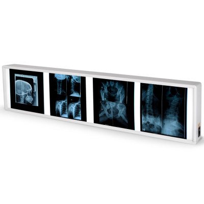 X RAY ILLUMINATOR - quadruple