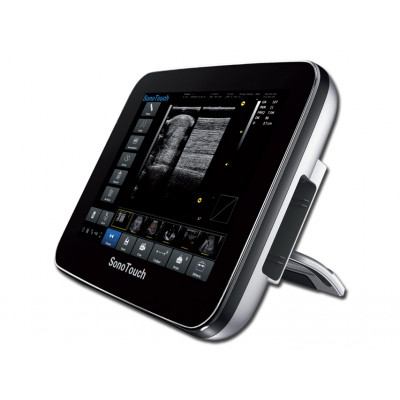 Chison sonotouch veterinaire colour ultrasound monitor