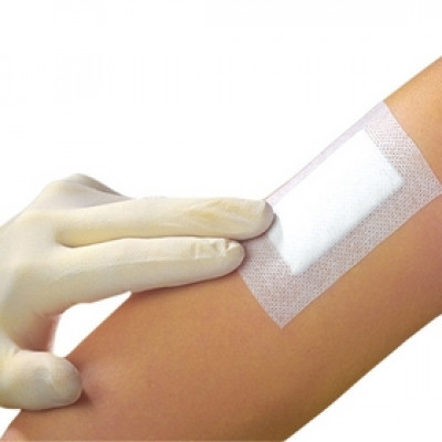 STERILE ADHESIVE DRESSING